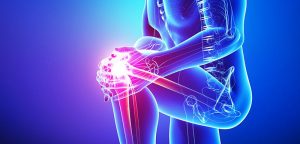 knee pain most common reason to see doctor